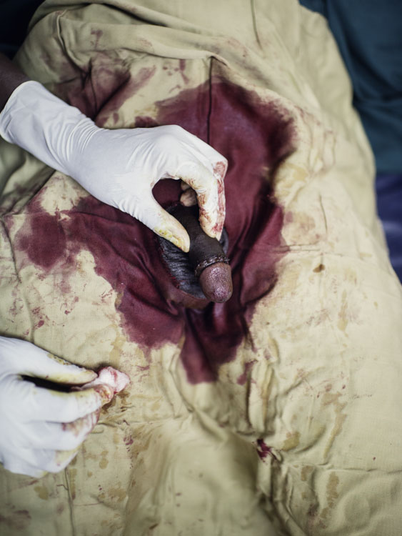 urban zintel photography — male circumcision